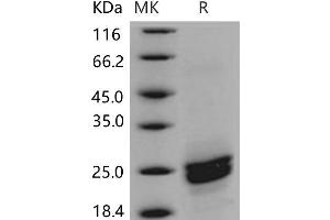 PLA2G12B Protein (His tag)