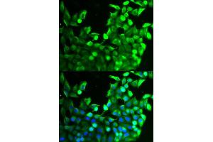 Immunofluorescence analysis of MCF-7 cells using FGFR2 antibody (ABIN5971103). (FGFR2 抗体)
