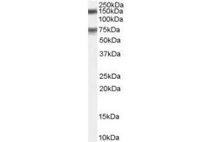Image no. 1 for anti-Maternal Embryonic Leucine Zipper Kinase (MELK) (C-Term) antibody (ABIN374073) (MELK 抗体  (C-Term))