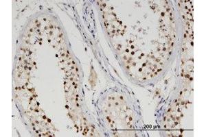 Image no. 1 for anti-tyrosyl-DNA phosphodiesterase 2 (TDP2) (AA 1-363) antibody (ABIN599560) (TDP2 抗体  (AA 1-363))