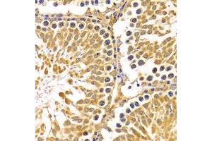 Immunohistochemistry of paraffin-embedded rat testis using PIBF1 Antibody. (PIBF1 抗体)