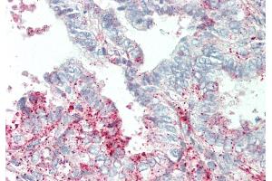 Immunohistochemistry (IHC) image for anti-Solute Carrier Family 39 (Metal Ion Transporter), Member 5 (SLC39A5) (N-Term) antibody (ABIN2781736)