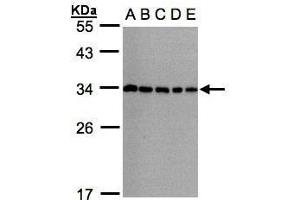 WB Image Sample(30μg whole cell lysate) A: 293T B: A431 , C: H1299 D: HeLa S3 , E: Hep G2 , 12% SDS PAGE antibody diluted at 1:1000 (CHMP5 抗体)