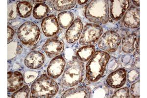 Image no. 2 for anti-3-Oxoacyl-ACP Synthase, Mitochondrial (OXSM) (AA 78-343) antibody (ABIN1491676) (OXSM 抗体  (AA 78-343))