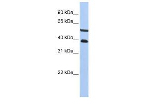PHACTR3 antibody used at 1 ug/ml to detect target protein. (PHACTR3 抗体  (C-Term))