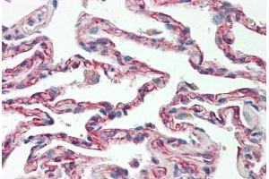 Image no. 2 for anti-TNFRSF1A-Associated Via Death Domain (TRADD) (AA 251-300) antibody (ABIN2879132) (TRADD 抗体  (AA 251-300))