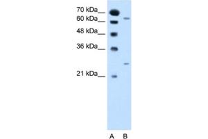 Western Blotting (WB) image for anti-N-Acetyltransferase 2 (Arylamine N-Acetyltransferase) (NAT2) antibody (ABIN2462790) (NAT2 抗体)
