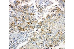 Immunohistochemistry (IHC) image for anti-Gap Junction Protein, alpha 1, 43kDa (GJA1) (AA 351-367) antibody (ABIN3031019)
