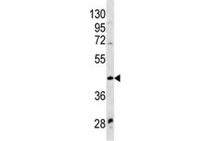 WNT9A antibody western blot analysis in NCI-H460 lysate (WNT9A 抗体  (AA 216-244))