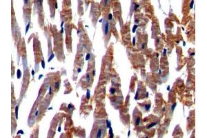 DAB staining on IHC-P; Samples: Rat Cardiac Muscle Tissue (NEXN 抗体  (AA 214-455))