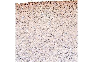 IHC analysis of CDK5 using anti-CDK5 antibody (ABIN6719393). (CDK5 抗体  (AA 1-226))