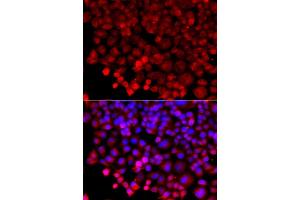 Immunofluorescence analysis of A549 cell using HARS antibody. (HARS1/Jo-1 抗体)