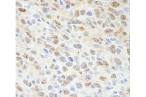Immunohistochemistry (IHC) image for anti-Mitogen-Activated Protein Kinase Associated Protein 1 (MAPKAP1) (C-Term) antibody (ABIN7448795) (MAPKAP1 抗体  (C-Term))