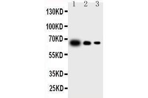 Western Blotting (WB) image for anti-Interleukin 23, alpha subunit p19 (IL23A) (AA 29-48), (N-Term) antibody (ABIN3043197) (IL23A 抗体  (N-Term))