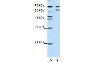 WB Suggested Anti-TCF3  Antibody Titration: 0. (TCF3 抗体  (N-Term))