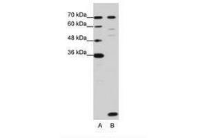 Image no. 3 for anti-LSM2 Homolog, U6 Small Nuclear RNA Associated (LSM2) (C-Term) antibody (ABIN202014) (LSM2 抗体  (C-Term))
