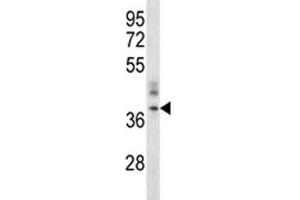 CRACM1 antibody western blot analysis in A375 lysate. (ORAI1 抗体  (AA 269-298))