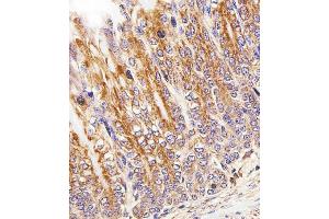 Immunohistochemical analysis of paraffin-embedded M. (Cytochrome C1 抗体  (AA 142-176))