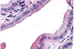 Immunohistochemical staining of human gallbladder, epithelium with CCKAR polyclonal antibody . (CCKAR 抗体  (N-Term))