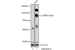 Western Blotting (WB) image for anti-Dynamin 1-Like (DNM1L) (pSer616) antibody (ABIN7266857)