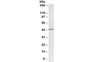 Western blot testing of human duodenum lysate with PAX3 antibody at 0. (Paired Box 3 抗体)