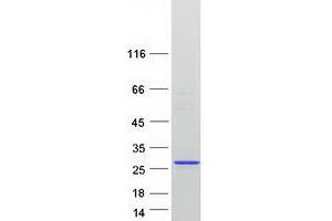 Western Blotting (WB) image for Mediator Complex Subunit 18 (MED18) (Transcript Variant 1) protein (Myc-DYKDDDDK Tag) (ABIN2725735)