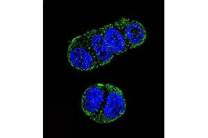 Confocal immunofluorescent analysis of FOLH1 Antibody (N-term) (ABIN657630 and ABIN2846626) with ZR-75-1 cell followed by Alexa Fluor 488-conjugated goat anti-rabbit lgG (green). (PSMA 抗体  (N-Term))