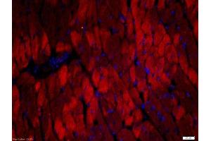 Paraformaldehyde-fixed, paraffin embedded rat heart, Antigen retrieval by boiling in sodium citrate buffer (pH6) for 15min, Block endogenous peroxidase by 3% hydrogen peroxide for 30 minutes, Blocking buffer (normal goat serum) at 37°C for 20min, Antibody incubation with Rabbit Anti-Troponin T Polyclonal Antibody, Unconjugated  at 1:500 overnight at 4°C, followed by a conjugated secondary Goat Anti-Rabbit IgG, Cy3 conjugated-Cy3)used at 1:200 dilution for 40 minutes at 37°C. (Troponin T 抗体  (AA 201-298))