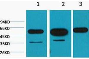 Western Blotting (WB) image for anti-Tubulin, beta (TUBB) antibody (ABIN3178688) (TUBB 抗体)
