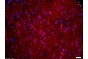 Formalin-fixed and paraffin embedded mouse brain labeled with Anti-phospho-Tau protein(Ser396) Polyclonal Antibody, Unconjugated (ABIN746453) at 1:200 followed by conjugation to the secondary antibody Goat Anti-Rabbit IgG, Cy3 conjugated used at 1:200 dilution for 40 minutes at 37°C and DAPI staining (tau 抗体  (pSer396))