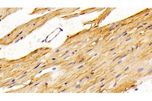 Detection of SPR in Mouse Cardiac Muscle Tissue using Polyclonal Antibody to Sepiapterin Reductase (SPR) (SPR 抗体  (AA 1-261))