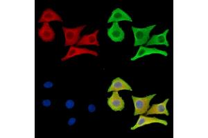 ABIN7096535 and ABIN7100599 staining Hela cells by IF/ICC. (LASS1 抗体)