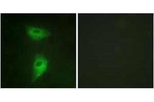 Immunofluorescence analysis of HeLa cells, using IGF2R (Ab-2409) Antibody. (IGF2R 抗体  (AA 2381-2430))