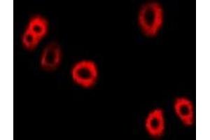 Immunofluorescent analysis of UBE2C staining in Hela cells. (UBE2C 抗体)