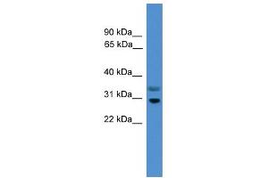 WB Suggested Anti-RGS18 Antibody Titration:  0. (RGS18 抗体  (Middle Region))