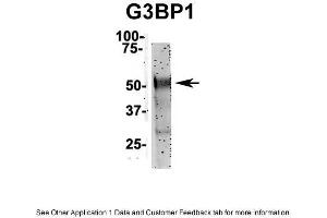 IP Suggested Anti-G3BP1 Antibody Positive Control: NT2 CELL/BRAIN TISSUE (G3BP1 抗体  (N-Term))