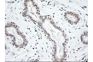 Immunohistochemical staining of paraffin-embedded breast using anti-NTF3 (ABIN2452683) mouse monoclonal antibody. (Neurotrophin 3 抗体  (AA 139-257))