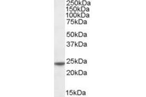 ABIN185188 (0. (Transgelin 抗体  (C-Term))