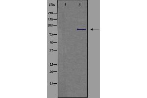 Western blot analysis of extracts from COLO cells, using CDH9 antibody. (Cadherin 9 抗体  (Internal Region))