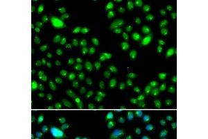 Immunofluorescence analysis of MCF-7 cells using L3MBTL3 Polyclonal Antibody (L3MBTL3 抗体)