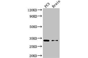 Western Blot Positive WB detected in: PC-3 whole cell lysate, Mouse brain tissue All lanes: HOXB13 antibody at 3 μg/mL Secondary Goat polyclonal to rabbit IgG at 1/50000 dilution Predicted band size: 31 kDa Observed band size: 31 kDa (HOXB13 抗体  (AA 1-161))