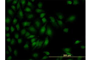 Immunofluorescence of monoclonal antibody to SMAD1 on HeLa cell. (SMAD1 抗体  (AA 1-110))