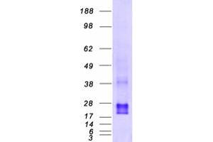 Validation with Western Blot (CDC42 Protein (Transcript Variant 2) (Myc-DYKDDDDK Tag))