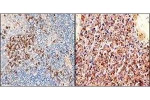 Immunohistochemistry (IHC) image for Rabbit anti-Human Ig (C-Term), (Chain kappa), (Light Chain) antibody (ABIN870368) (兔 anti-人 Ig (C-Term), (Chain kappa), (Light Chain) Antibody)