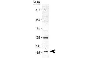 Western blot analysis of TMED10 in human liver lysate with TMED10 polyclonal antibody . (TMED10 抗体  (AA 50-150))