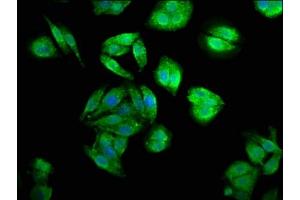Immunofluorescence staining of HepG2 cells with ABIN7147362 at 1:200, counter-stained with DAPI. (CENPJ 抗体  (AA 1082-1248))