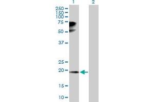 Western Blot analysis of TPRKB expression in transfected 293T cell line by TPRKB MaxPab polyclonal antibody. (TPRKB 抗体  (AA 1-175))