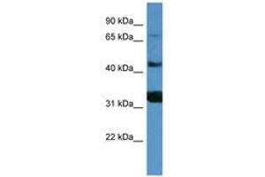 Image no. 1 for anti-Antigen P97 (Melanoma Associated) Identified By Monoclonal Antibodies 133.2 and 96.5 (MFI2) (AA 518-567) antibody (ABIN6746807) (MFI2 抗体  (AA 518-567))