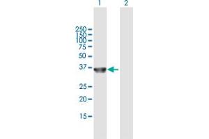 Western Blotting (WB) image for anti-Collagen, Type XXIII, alpha 1 (COL23A1) (AA 1-309) antibody (ABIN949768)