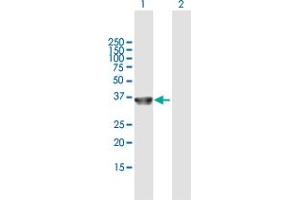 Western Blot analysis of COL23A1 expression in transfected 293T cell line by COL23A1 MaxPab polyclonal antibody. (COL23A1 抗体  (AA 1-309))